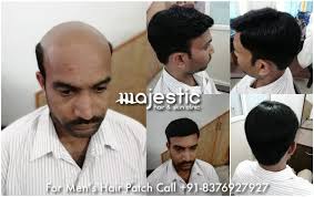 Majestic Hair And Skin Clinic